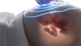 Mẹ bầu siêu âm thai nhiều lần có nên không? Những điều cần biết để theo dõi thai kỳ đúng cách