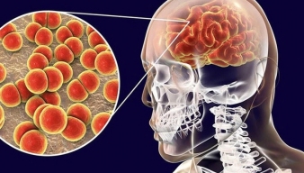 Ca mắc não mô cầu có xu hướng gia tăng – Chủ động phòng bệnh từ sớm để bảo vệ cộng đồng