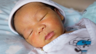 5 cách chăm sóc trẻ sơ sinh bị vàng da